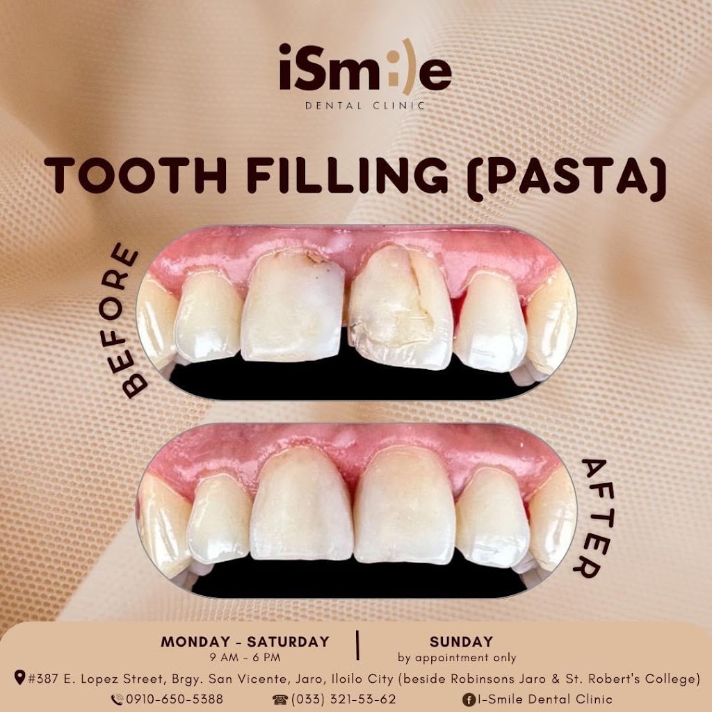 iSmile Dental Clinic - Jaro — photo 6