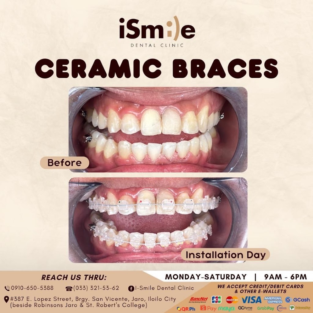 iSmile Dental Clinic - Jaro — photo 8