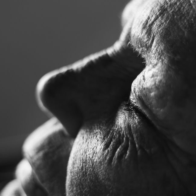 Before — Anti-aging program